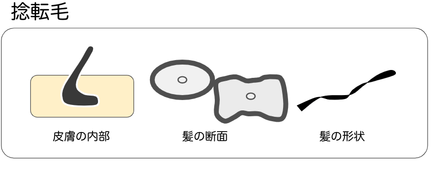 捻転毛の図